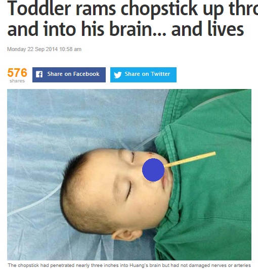 中国の2歳児、箸が鼻から脳へ刺さる（画像はmetro.co.ukのスクリーンショット）