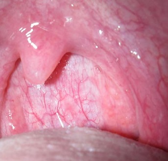 喉に棲みつく微生物が脳機能を左右か（画像はイメージです）