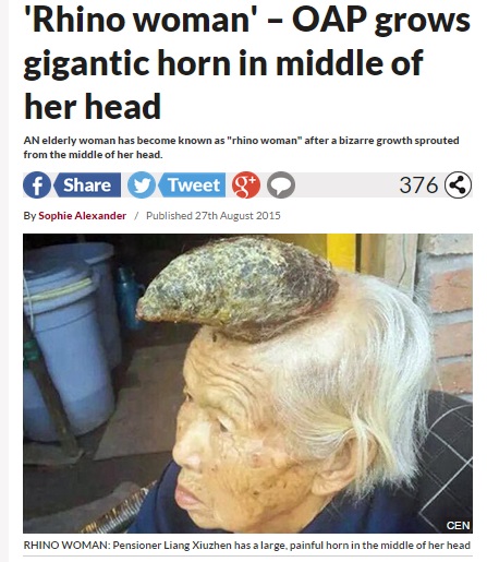 頭に13cm長の角が生えている87歳の中国人女性（画像はdailystar.co.ukのスクリーンショット）