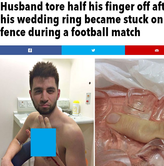 サッカー試合中の事故で指を切断（出典：http://www.thesun.co.uk）