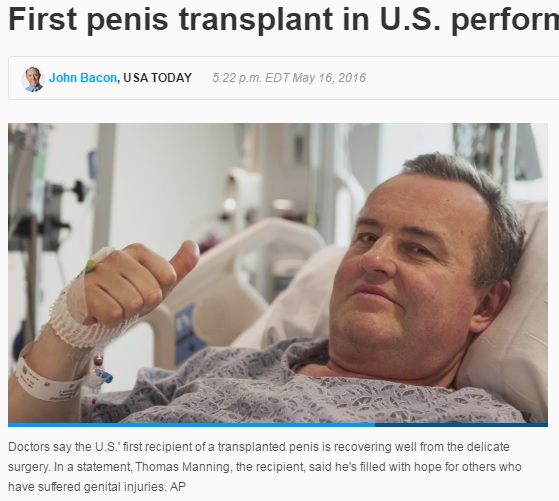 米国初のペニス移植を受けた男性（出典：http://www.usatoday.com）