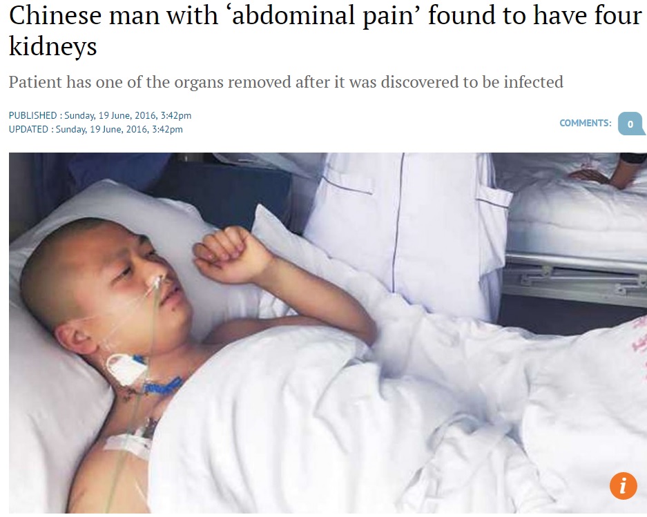 【海外発！Breaking News】「腎臓が4つもあった」中国の男性　腹痛で発覚