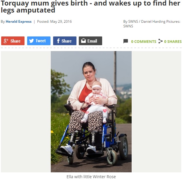 出産後、膝下を失った女性（出典：http://www.torquayheraldexpress.co.uk）