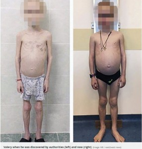 保護前（左）と現在の男児（右）（画像は『Mirror　2017年11月14日付「Boy， 11， weighed TWO STONE after ‘foster mum starved and drugged him to claim sickness benefits for luxuries’」（Image: MK / east2west news）』のスクリーンショット