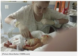 生まれてから数日後のジェイミソン君と母アリシアさん（画像は『Metro　2018年6月20日付「Mum bathes her baby in bleach twice a week to help him fight infection」（Picture: Alicia Barber / SWNS.com）』のスクリーンショット