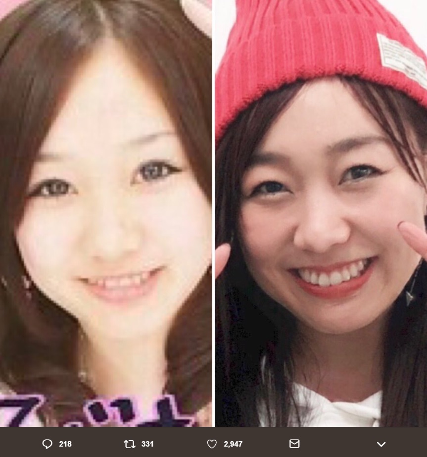 須田亜香里、17歳時のプリクラと2019年頭に撮った1枚（画像は『須田亜香里（SKE48）　2019年1月28日付Twitter「昨日のサンジャポで出してた10年前のプリクラと似ている髪型があったので並べてみた。」』のスクリーンショット）