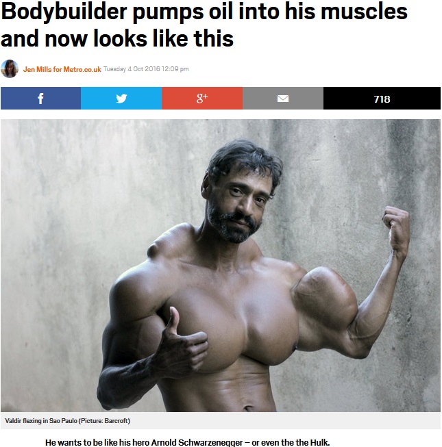 体にオイルを注入し続けるブラジルの男性（出典：http://metro.co.uk）