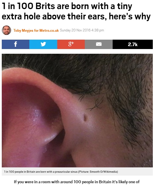 あなたの耳の付け根に小さな孔（穴）はある!?（出典：http://metro.co.uk）