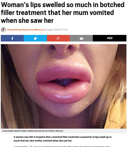 母を嘔吐させるほどの酷い施術を受けた娘（出典：http://metro.co.uk）