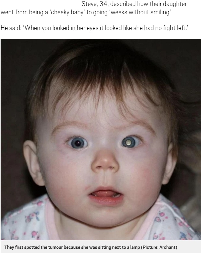 生後8か月で目に腫瘍が見つかった女児（出典：http://metro.co.uk）