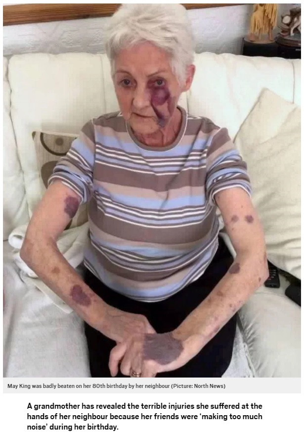 80歳誕生日に酷い目に遭った女性（画像は『Metro　2017年6月16日付「Grandmother beaten black and blue for‘making too much noise’at her birthday」（Picture: North News）』のスクリーンショット）