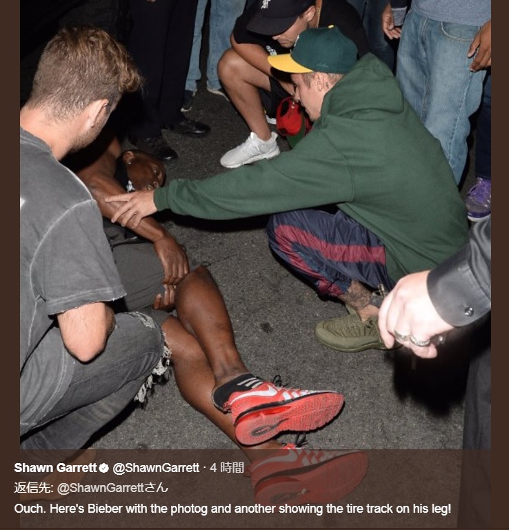 パパラッチに寄り添うジャスティン（画像は『Shawn Garrett　2017年7月27日付Twitter「Ouch. Here's Bieber with the photog and another showing the tire track on his leg!」』のスクリーンショット）