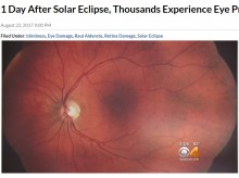 【海外発！Breaking News】皆既日食に沸いたアメリカ、数千人が目の異常で眼科を受診か