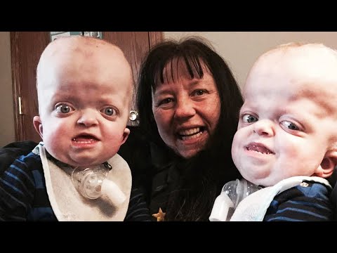 遺伝子異常がある双子を養子にした元看護師（画像は『Inside Edition　2017年8月11日公開 YouTube「Grandma Adopts Twins With Rare Genetic Disease, Says She's ‘Privileged’』のサムネイル）