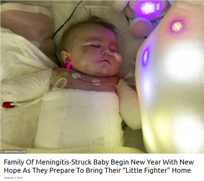 髄膜炎で一命を取り留めるも、四肢切断になった1歳児にようやく退院の兆し（画像は『real fix　2018年1月2日付「Family Of Meningitis-Struck Baby Begin New Year With New Hope As They Prepare To Bring Their “Little Fighter” Home」』のスクリーンショット）