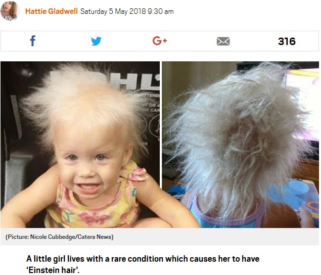 「櫛でとかせない頭髪症候群」の女の子（画像は『Metro　2018年5月5日付「Little girl has rare condition which causes her to have hair like Albert Einstein」（Picture: Nicole Cubbedge/Caters News）』のスクリーンショット）