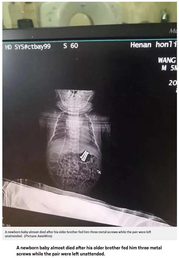 3歳兄にねじを食べさせられた男児（画像は『Metro　2018年6月7日付「Baby almost dies after brother, 3, fed him three screws while mum was out」（Picture: AsiaWire）』のスクリーンショット）