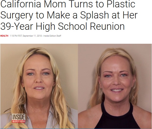 整形して39年ぶりの同窓会に出席した女性（画像は『Inside Edition　2018年9月11日付「California Mom Turns to Plastic Surgery to Make a Splash at Her 39-Year High School Reunion」』のスクリーンショット）