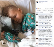 【海外発！Breaking News】ポップコーンで誤嚥性肺炎を起こした2歳児　母親がFacebookで注意喚起（米）
