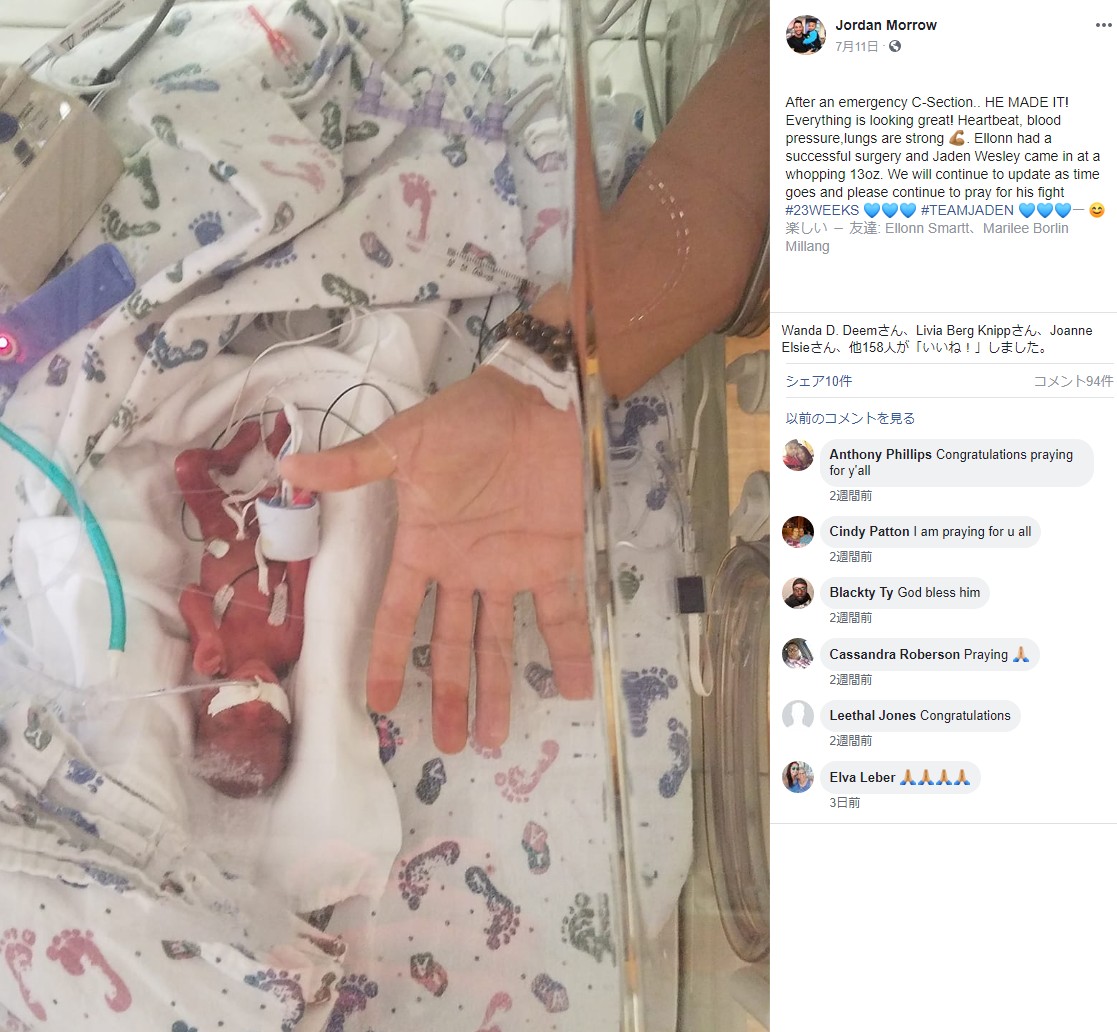 わずか369グラムで誕生した男の子（画像は『Jordan Morrow　2019年7月11日付Facebook「After an emergency C-Section.. HE MADE IT!」』のスクリーンショット）