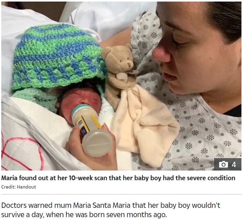 医師に中絶を勧められた母親と誕生した男児（画像は『The Sun　2019年10月3日付「MIRACLE BOY Baby is ‘first in world’ to survive being born with his brain OUTSIDE his skull」（Credit: Handout）』のスクリーンショット）