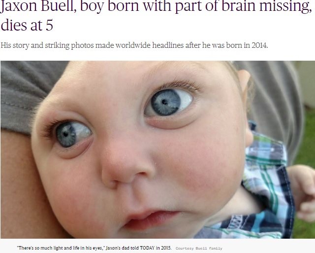 2015年のジャクソン君（画像は『TODAY　2020年4月7日付「Jaxon Buell, boy born with part of brain missing, dies at 5」（Courtesy Buell family）』のスクリーンショット）