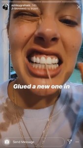 キレイに生まれ変わった前歯を披露するアシュリー（画像は『A S H L E Y G R A H A M　2020年6月18日付Instagram』のスクリーンショット）