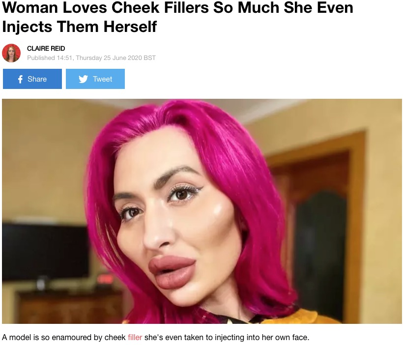 チークフィラーに夢中の女性（画像は『LADbible　2020年6月25日付「Woman Loves Cheek Fillers So Much She Even Injects Them Herself」（Credit: Jam Press）』のスクリーンショット）