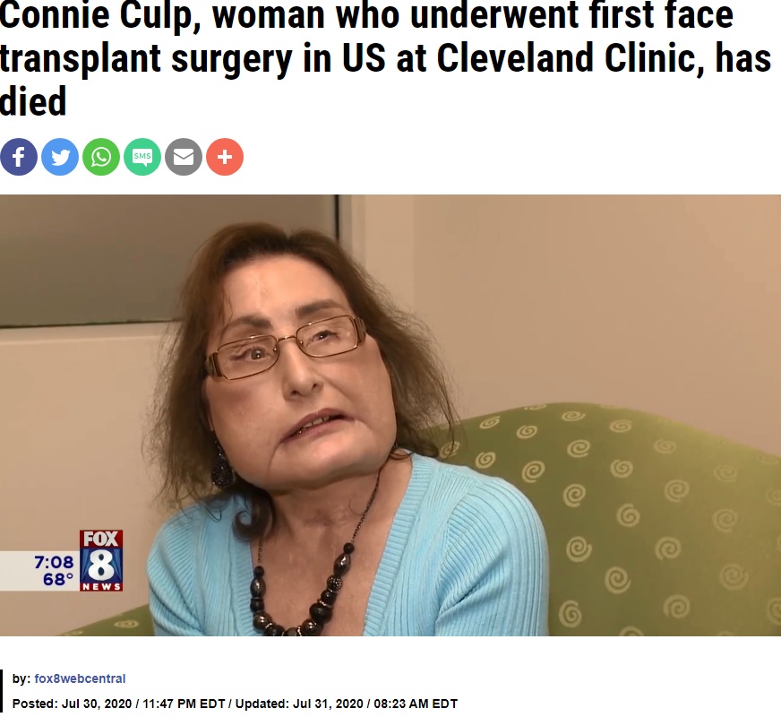 57歳で亡くなったコニー・カルプさん（画像は『FOX 8 News　2020年7月30日付「Connie Culp, woman who underwent first face transplant surgery in US at Cleveland Clinic, has died」』のスクリーンショット）