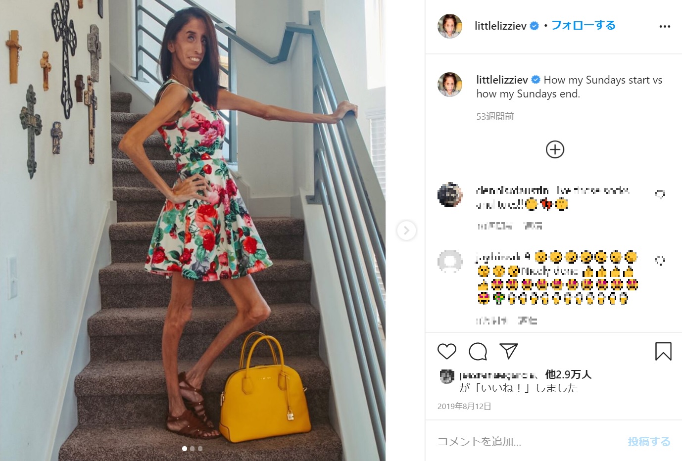 稀な疾患で体重30キロにも満たないリジーさん（画像は『Lizzie Velasquez　2019年8月12日付Instagram「How my Sundays start vs how my Sundays end.」』のスクリーンショット）