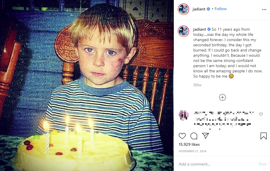 火傷する前、当時4歳のジョンさん（画像は『Johnny　2014年11月21日付Instagram「So 11 years ago from today」』のスクリーンショット）