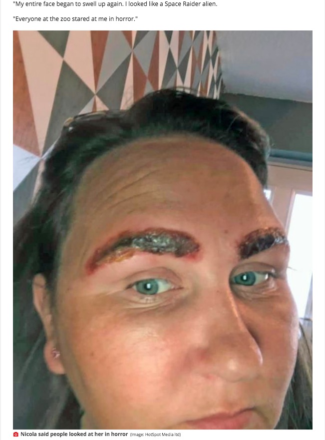 眉が「赤いナメクジ」のようになってしまったニコラさん（画像は『Mirror　2020年10月28日付「Eyebrow tint almost killed woman and left her looking ‘like Space Raider alien’」（Image: HotSpot Media ltd）』のスクリーンショット）