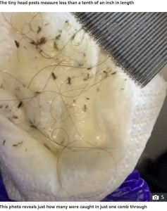 梳き櫛でとれたシラミ（画像は『The Sun　2020年10月1日付「BUGS STRIFE Skin-crawling video shows THOUSANDS of head lice wriggling in woman’s hair」』のスクリーンショット）
