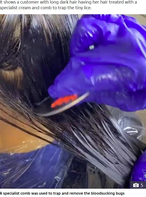 クリニックでシラミを取り除いてもらう女児（画像は『The Sun　2020年10月1日付「BUGS STRIFE Skin-crawling video shows THOUSANDS of head lice wriggling in woman’s hair」』のスクリーンショット）