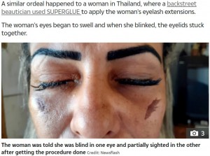 【海外発！Breaking News】まつ毛エクステ施術中に接着剤が目に　女性が片目を失明（ブラジル）