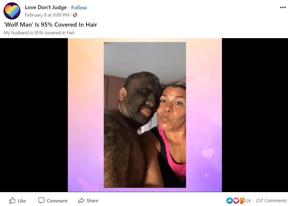 結婚して4年になるゲイブリエルさんとアリシアさん（画像は『Love Don’t Judge　2021年2月8日付Facebook「‘Wolf Man’ Is 95％ Covered In Hair」』のスクリーンショット）