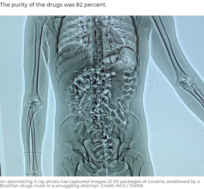 消化器官にびっしりと詰め込まれたコカインの小袋（画像は『7NEWS.com.au　2021年2月1日付「Brazilian sex worker swallows 101 cocaine packages in UK drug smuggling stunt」（Credit: NCA / SWNS）』のスクリーンショット）