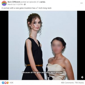 11歳から身長がぐんぐん伸びたというリュドミーラさん（画像は『Born Different　2021年3月8日付Facebook「A woman with a rare gene mutation has a 7-inch-long neck」』のスクリーンショット）