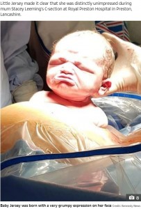 下唇を突き出して不機嫌そうなジャージーちゃん（画像は『The Sun　2021年3月19日付「LOOK WHO’S SULKING Newborn emerges into world for first time pulling grumpiest face possible - and mum says she’s still grumpy two years on」（Credit: Kennedy News）』のスクリーンショット）