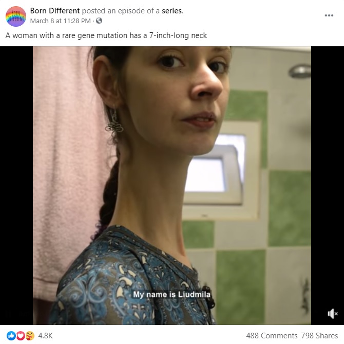 長い首が印象的な女性（画像は『Born Different　2021年3月8日付Facebook「A woman with a rare gene mutation has a 7-inch-long neck」』のスクリーンショット