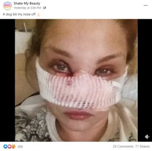 手術を受け、精神的に落ち込んでいた時期（画像は『Shake My Beauty　2021年3月7日付Facebook「A dog bit my nose off」』のスクリーンショット）