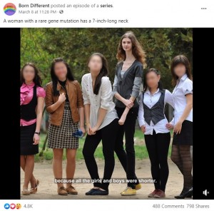 高身長でどうしても目立ってしまうリュドミーラさん（画像は『Born Different　2021年3月8日付Facebook「A woman with a rare gene mutation has a 7-inch-long neck」』のスクリーンショット）