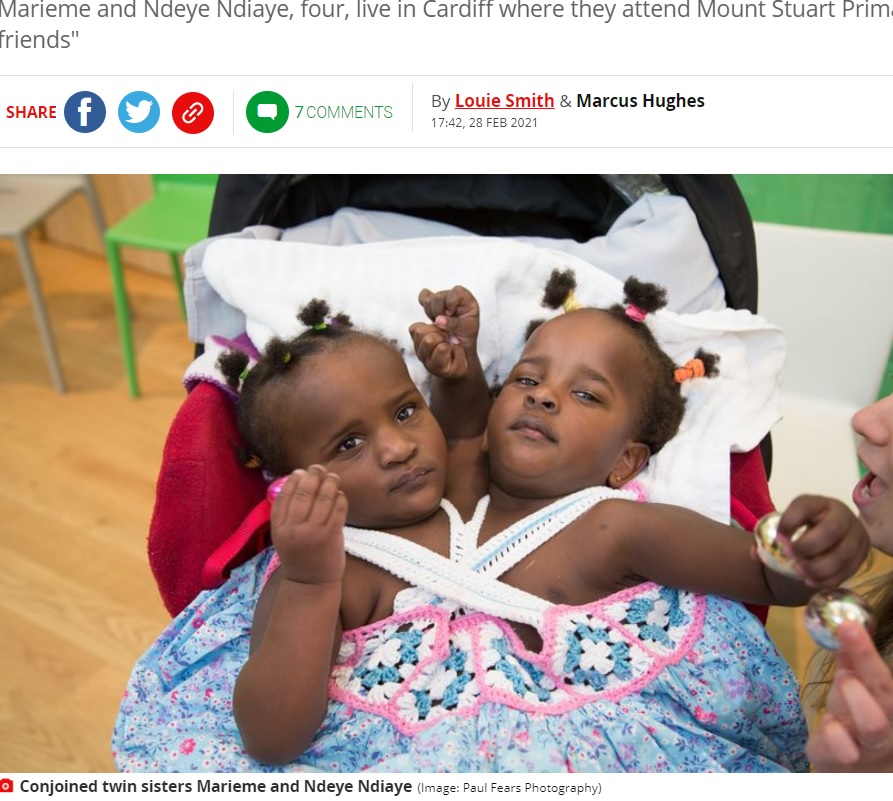 イギリスで治療を受ける結合双生児の2人（画像は『Mirror　2021年2月28日付「Conjoined twins not expected to live now learning to walk and thriving at school」（Image: Paul Fears Photography）』のスクリーンショット）