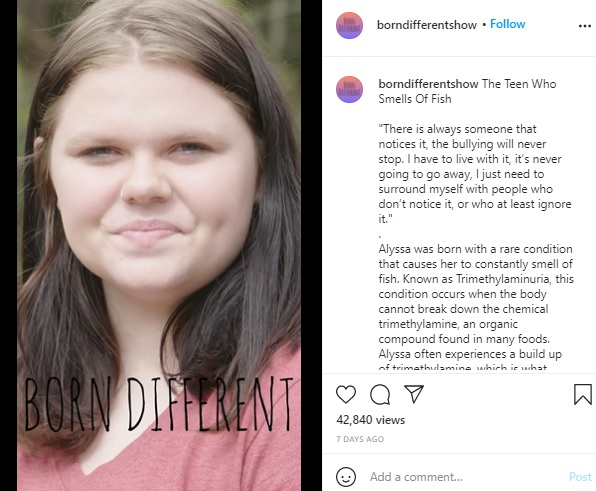 腐った魚の臭いを放つ「トリメチルアミン尿症」に苦しむ女性（画像は『Born Different　2021年4月23日付Instagram「The Teen Who Smells Of Fish」』のスクリーンショット）