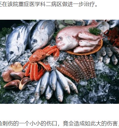 傷がある時は、魚介類の取り扱いに注意が必要（画像は『网易　2021年5月23日付「危急丨临桂一厨师被海鱼扎伤手指，左臂被两次截肢保命...」（每日桂林）』のスクリーンショット）