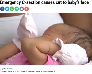【海外発！Breaking News】緊急帝王切開で誕生の女児の顔に傷、13針を縫う　医師の説明に家族激怒（米）