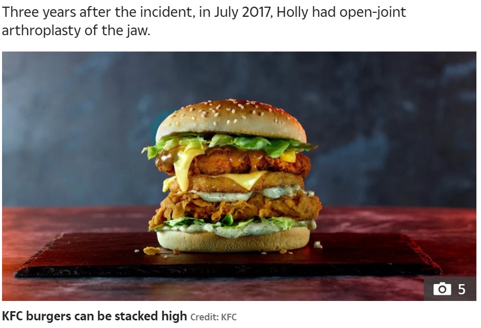 大きなバーガーのせいで、女性は何年も痛みに耐え続けることに（画像は『The Sun　2021年8月11日付「BURGER ME Woman’s horror at dislocating her jaw after eating a KFC burger」（Credit: KFC）』のスクリーンショット）