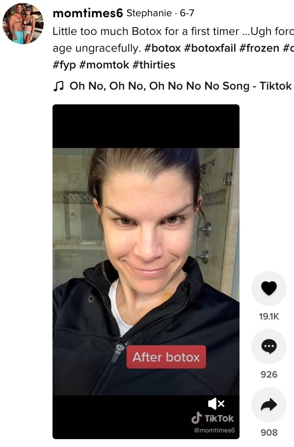 ボトックス後、威嚇するジャック・ニコルソンのように（画像は『Stephanie　2021年6月7日付TikTok「Little too much Botox for a first timer …」』のスクリーンショット）