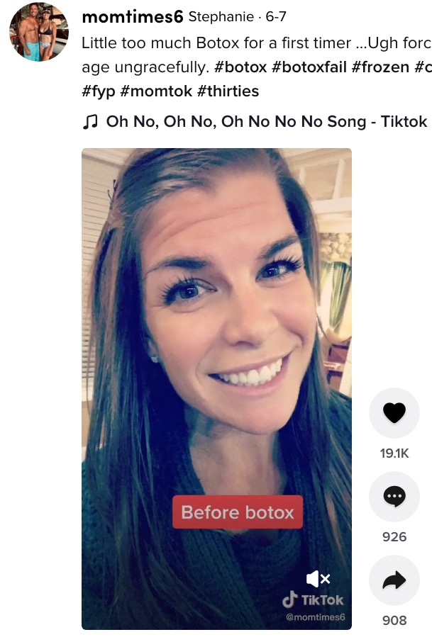 ボトックス施術を受ける前の女性（画像は『Stephanie　2021年6月7日付TikTok「Little too much Botox for a first timer …」』のスクリーンショット）