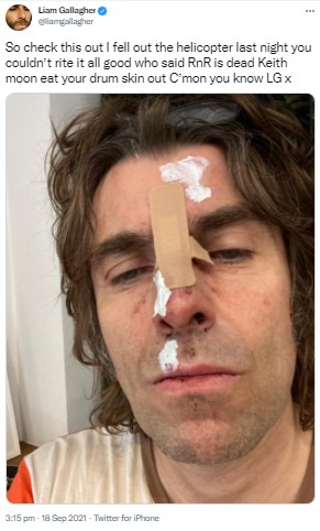 大きな絆創膏を貼ったリアムの顔（画像は『Liam Gallagher　2021年9月18日付Twitter「So check this out I fell out the helicopter last night you couldn’t rite it all good who said RnR is dead Keith moon eat your drum skin out C’mon you know LG x」』のスクリーンショット）